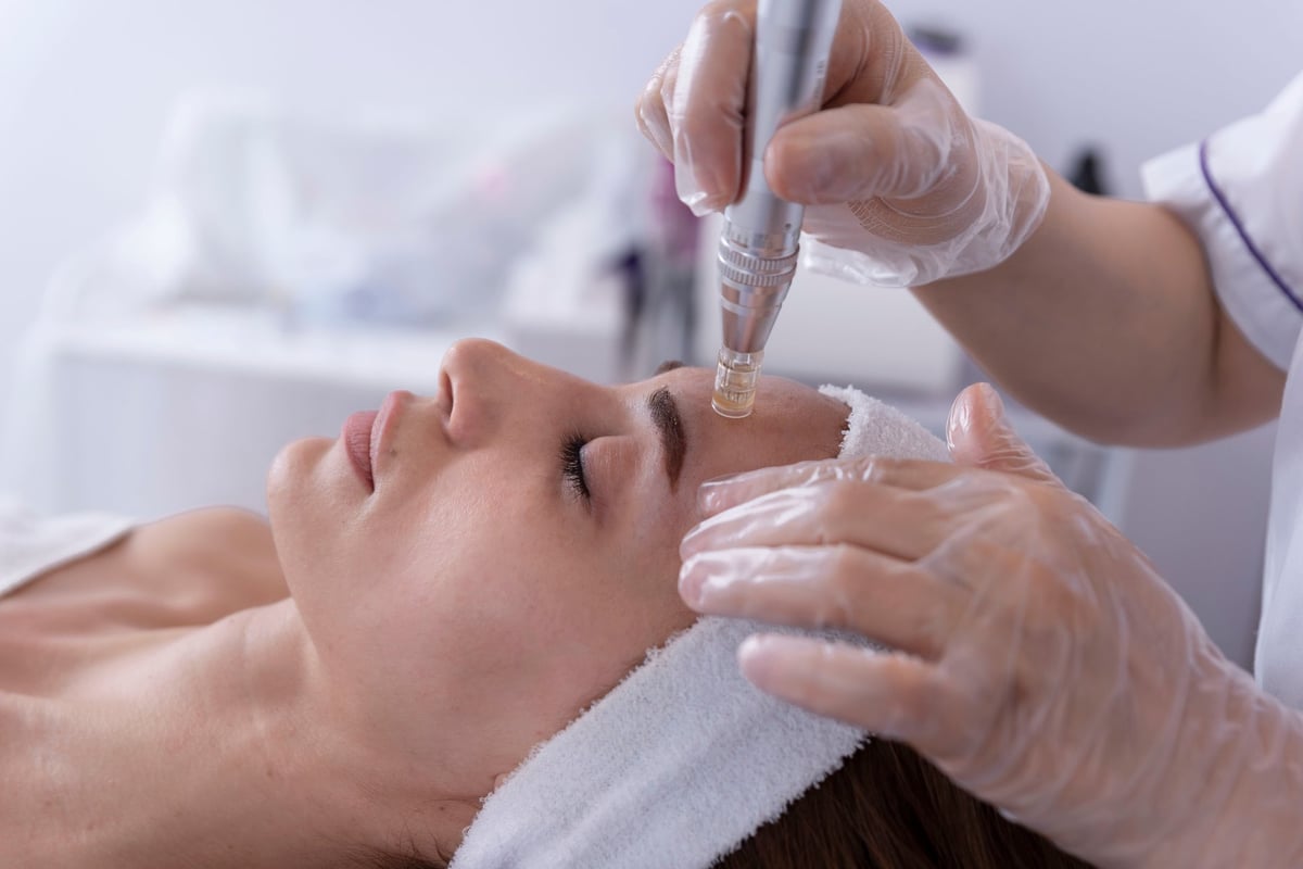 Cosmetologist applying a dermapen microneedling treatment on a young woman's face in a beauty studio